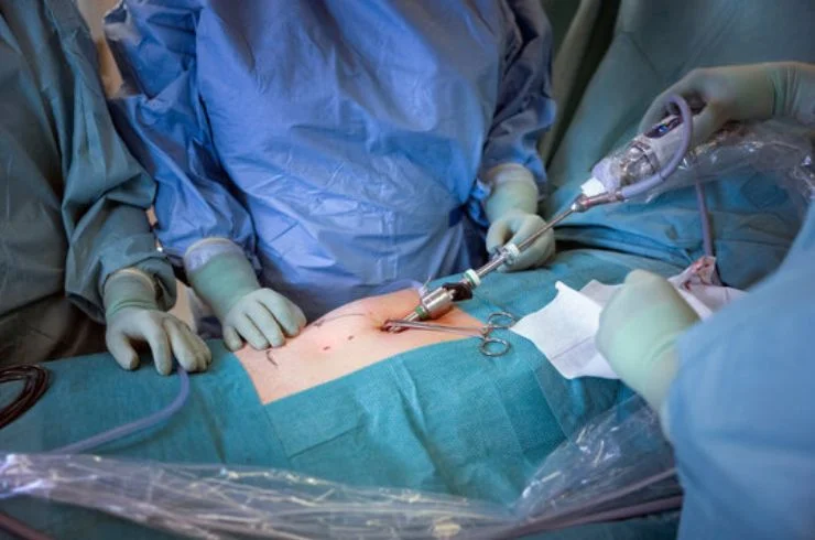 Laparoscopic and Hysteroscopic Surgeries